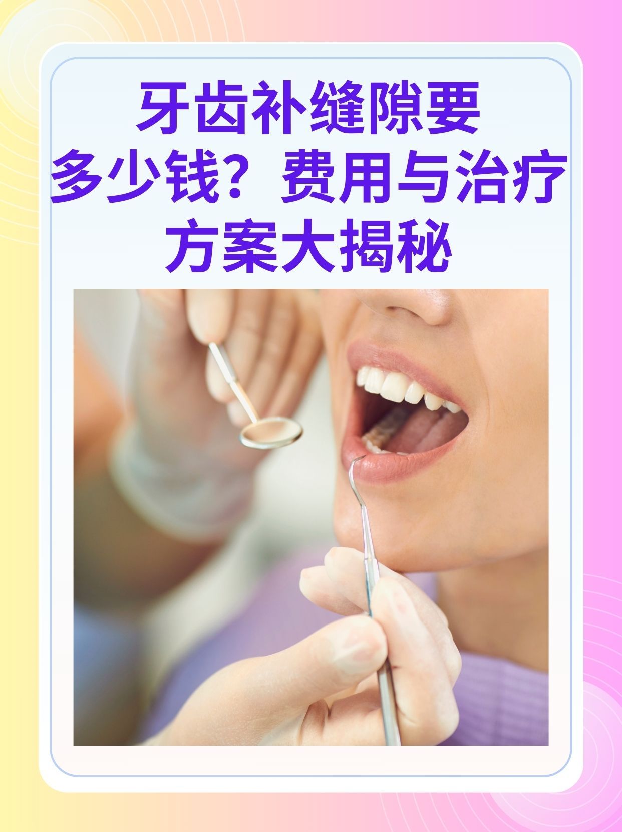 白城补牙医保可以报销吗(补牙医保可以报销吗 哪些可以报销呢)